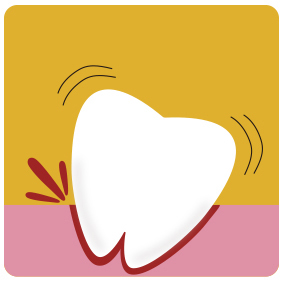 歯周病の歯のイメージ